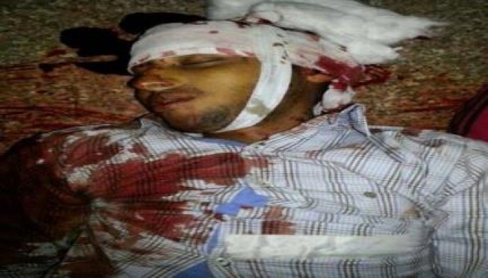 جيش 73 حارب تحت صيحات التكبير .. وجيش السيسي يقتل من يصيحون بالتكبير