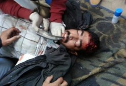 مليونية "دستورنا 2012" إصابة مواطن بطلق ناري في السويس وآخر في القاهرة