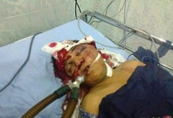 وفاة الناشط باسم محسن عضو تمرد السابق متأثرا باصابته بطلق ناري الجمعة الماضية بالسويس