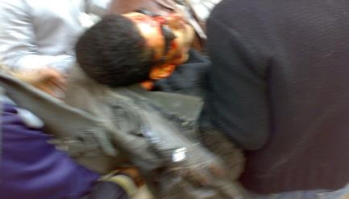 "الشعب يشعل ثورته": ارتقاء شهيدين بالاسماعيلية وثالث بمدينة نصر