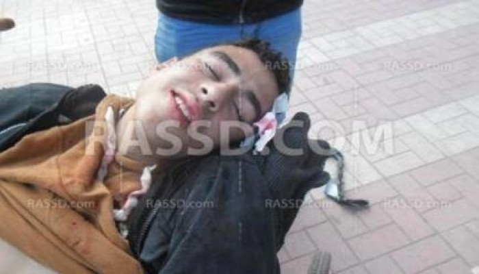 11 شهيد  .. حصيلة عنف كلاب السيسي الضالة ضد تظاهرات اليوم .. والثوار صامدون !