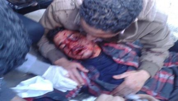 عشرات الاصابات في صفوف طلاب أسيوط بينهم 7 حالات خطرة جراء اعتداء أمن الانقلاب علي الجامعة