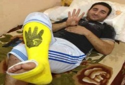 صورة وتعليق .. صامدون رغم الاصابة