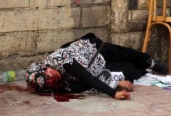 إصابة طالبة أزهرية بالخرطوش في الوجه اثر اعتداء قوات أمن الانقلاب عليهم منذ قليل