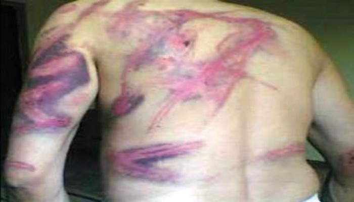 حسبنا الله ونعم الوكيل .. تعرض بعض المعتقلين للتعذيب داخل مديرية الأمن بالإسكندرية