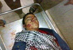 بالصور.. ارتفاع عدد الشهداء الي 5 ببني سويف والثوار يدعون للتصعيد