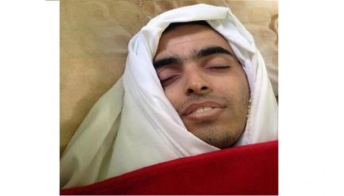 إبتسامة شهيد ..