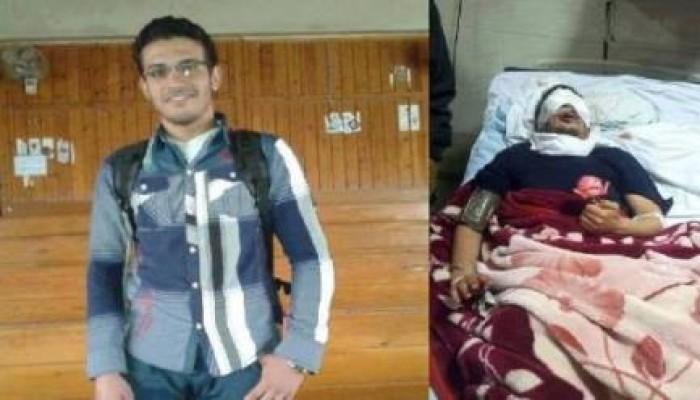 إسلام رشدي.. في طريقه لفقد بصره بسجون الانقلاب