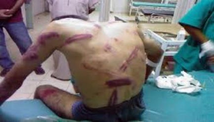 "سلخانه الدور الرابع " هاشتاج لتوثيق ممارسات  الداخليه ضد المعتقلين بمديرية امن الاسكندرية