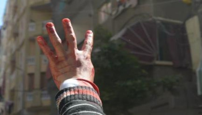 صورة اليوم .. رغم التنكيل والاجرام الصمود للثورة عنوان