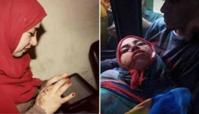 الانقلابيون يلفقون تهمة قتل صحفية الدستور لمتظاهر مصاب !