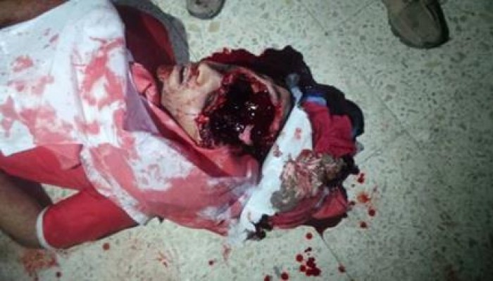 طلاب الأزهر يناشدون المنظمات الإنسانية والحقوقية بالتدخل لوقف الاعتداء عليهم