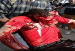 استشهاد طالب التجارة بعد قنصه برصاص الداخلية وطالبين بحالة خطرة