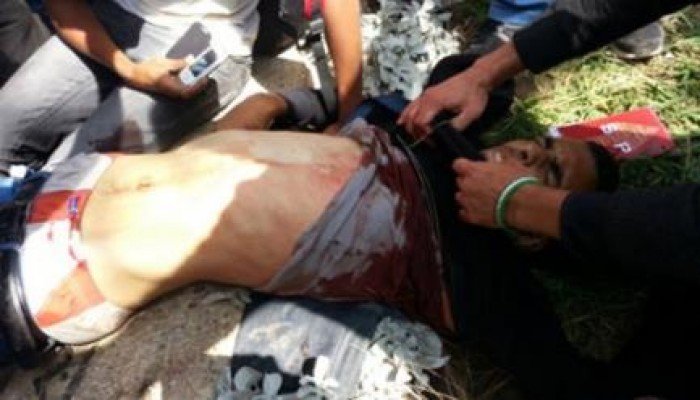 اصابه محرر اليوم السابع برصاص حى خلال اعتداء داخلية الانقلاب على جامعة القاهرة