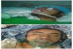 اصابة الطالب أحمد عبدالستار خلال الاعتداء على طلاب جامعة ‫‏الأزهر‬