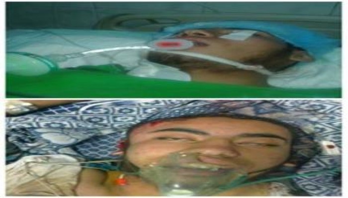 اصابة الطالب أحمد عبدالستار خلال الاعتداء على طلاب جامعة ‫‏الأزهر‬