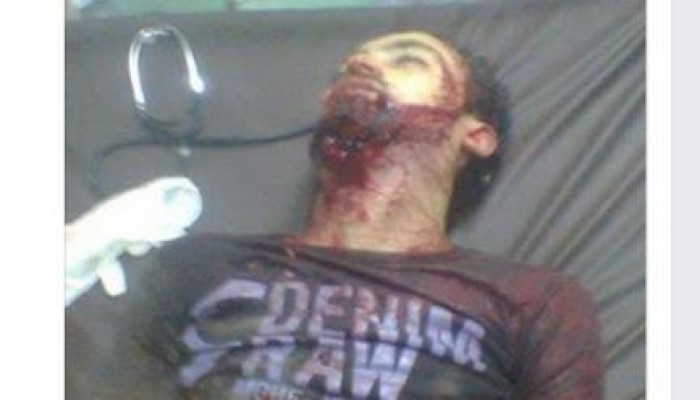 دمياط .. مصرع شخص برصاص بلطجية أثناء مرور مسيرة ضد الانقلاب