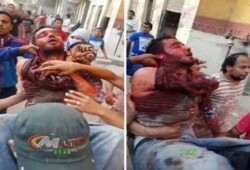 ارتفاع شهداء حلوان الي 5 بخلاف عشرات الاصابات