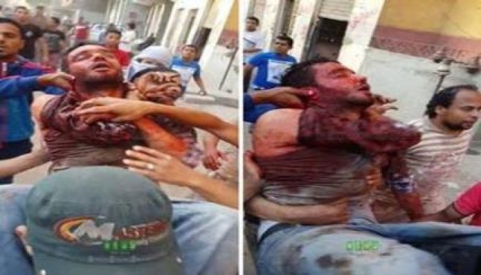 ارتفاع شهداء حلوان الي 5 بخلاف عشرات الاصابات