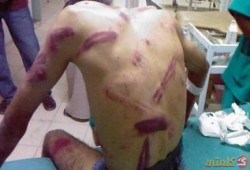 مالك أنس .. خلعوا كتفيه من التعذيب بسجن "العزولى" دون تهمة