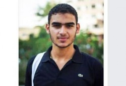 إصابة رئيس إتحاد طلاب صيدلة-المنصورة بتشوه جلدي بسبب إلقاء ضابط "شاي مغلي" على يده
