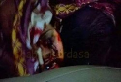 كلاب الأمن تقتل سيدة بكرداسة أثناء حملة اعتقالات