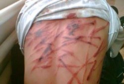 العفو الدولية: تعذيب عشرات المدنيين في سجن سري بالإسماعيلية