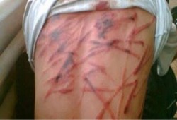 الاسكندرية: المجرم ياسر شلبي مأمور قسم الرمل ثان يشرف علي تعذيب طالبين