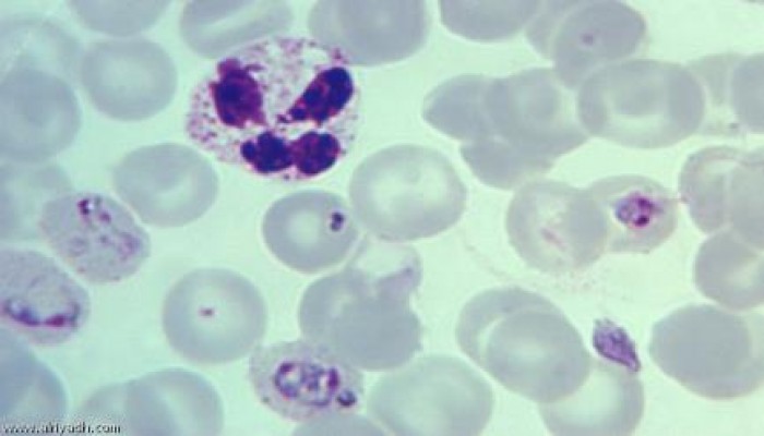 "النحس" .. الملاريا تصيب 26 شخصاً بأسوان.. و700 شخص تحت الفحص