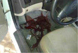 بالصور : إصابة مواطن برصاص قناصة قسم الشيخ زويد