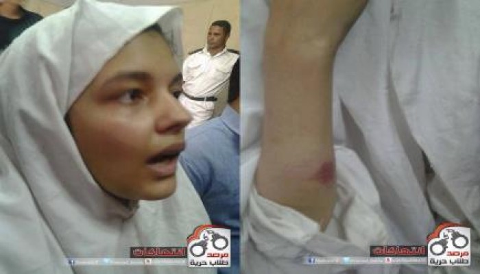 مطاوع : قوات الاانقلاب تعتدي علي الفتيات المعتقلاب "بسجن القناطر" و اصابات بالنزيف وكسور