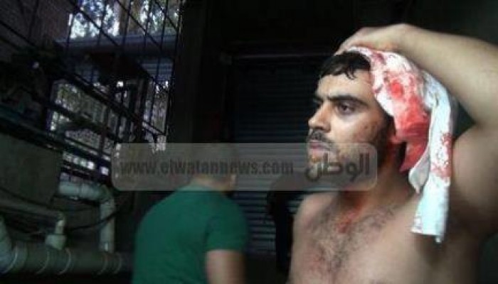 صورةوتعليق " صحفي جريدة الوطن بعد ضربه من الشرطة "