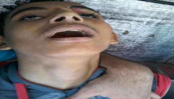 استشهاد طفل برصاص حي من كلاب  الداخلية في مسيرة المطرية ضد الانقلاب