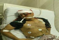 استشهاد كريم شامة متأثراً بجراحة بعد اصابته بثلاث رصاصات من الانقلاب بمسيرة المطرية أمس