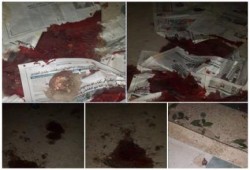 انفجار العريش (صور)