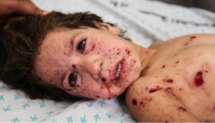 حصيلة العدوان على غزة 230 شهيدا