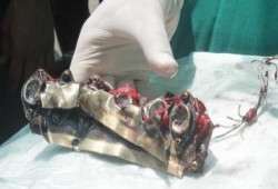 أسلحة محرمة دوليا بعدوان الصهاينة على غزة