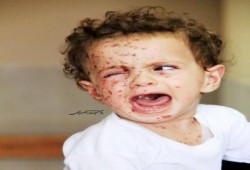 هؤلاء أطفال فلسطين يا عرب