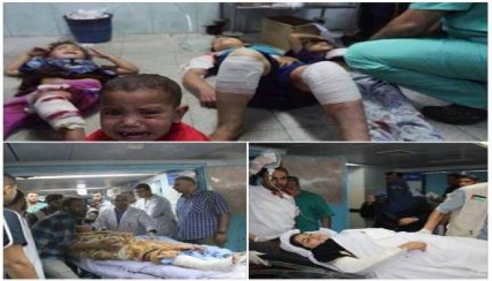 صور لبعض مصابي قصف الاحتلال الصهيوني لمدرسة تابعة للأونروا ببيت حانون ‫بغزة