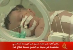 "يخرج الحي من الميت" .. إخراج جنين فلسطيني حي من بطن أمه الشهيدة