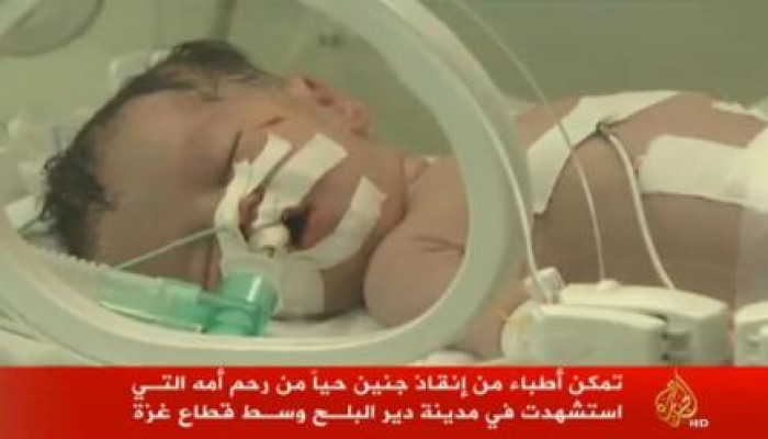 "يخرج الحي من الميت" .. إخراج جنين فلسطيني حي من بطن أمه الشهيدة