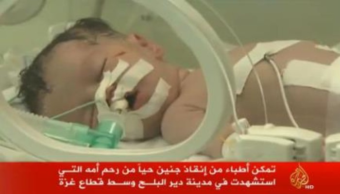 "يخرج الحي من الميت" .. إخراج جنين فلسطيني حي من بطن أمه الشهيدة