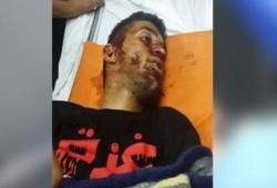 شهيد وأكثر من 40 جريحا بمواجهات مع الاحتلال بالضفة الغربية