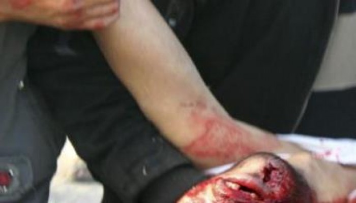 وفاة سجين جنائى بحجز مركز شرطة فارسكور بسبب رفض المأمور ورئيس المباحث علاجه