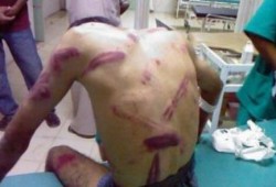 منظمة حقوقية في بريطانيا تكشف تفاصيل تعذيب طالب بالأزهر