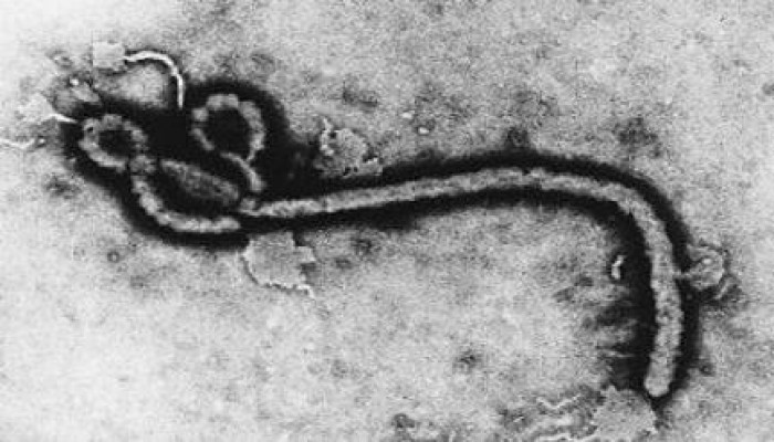 أول حالة اشتباه بفيروس "إيبولا" القاتل في مصر