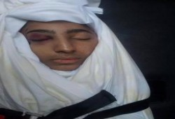 صورة الطفل الشهيد "حسن نادي حسن" شهيد تعذيب الداخلية