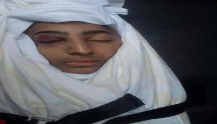 صورة الطفل الشهيد "حسن نادي حسن" شهيد تعذيب الداخلية