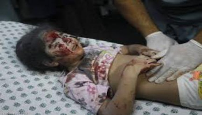 "الصحة الفلسطينية" تدعو إلى "تحقيق دولي" في استخدام إسرائيل أسلحة محرّمة ضد  ‏غزة
