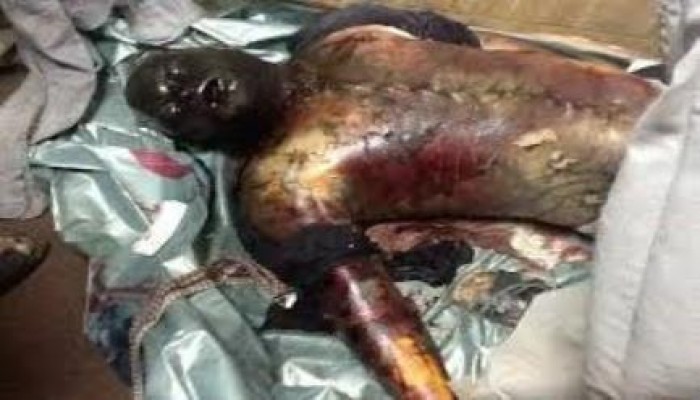 الجارديان : كيف مات 37 سجينا في سيارة ترحيلات أبو زعبل ؟